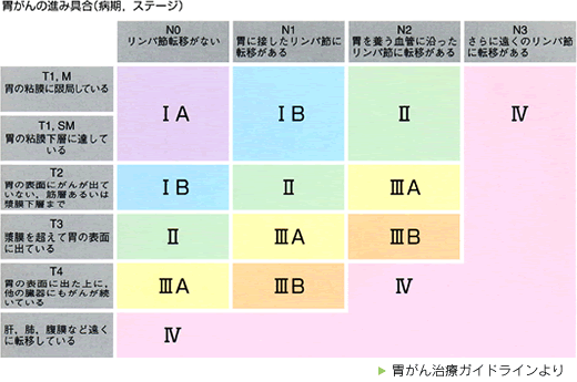 胃がんのステージ分類