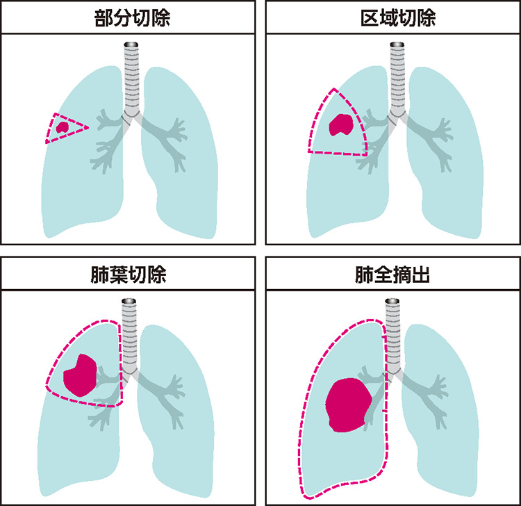 手術1