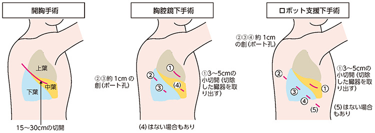 手術2