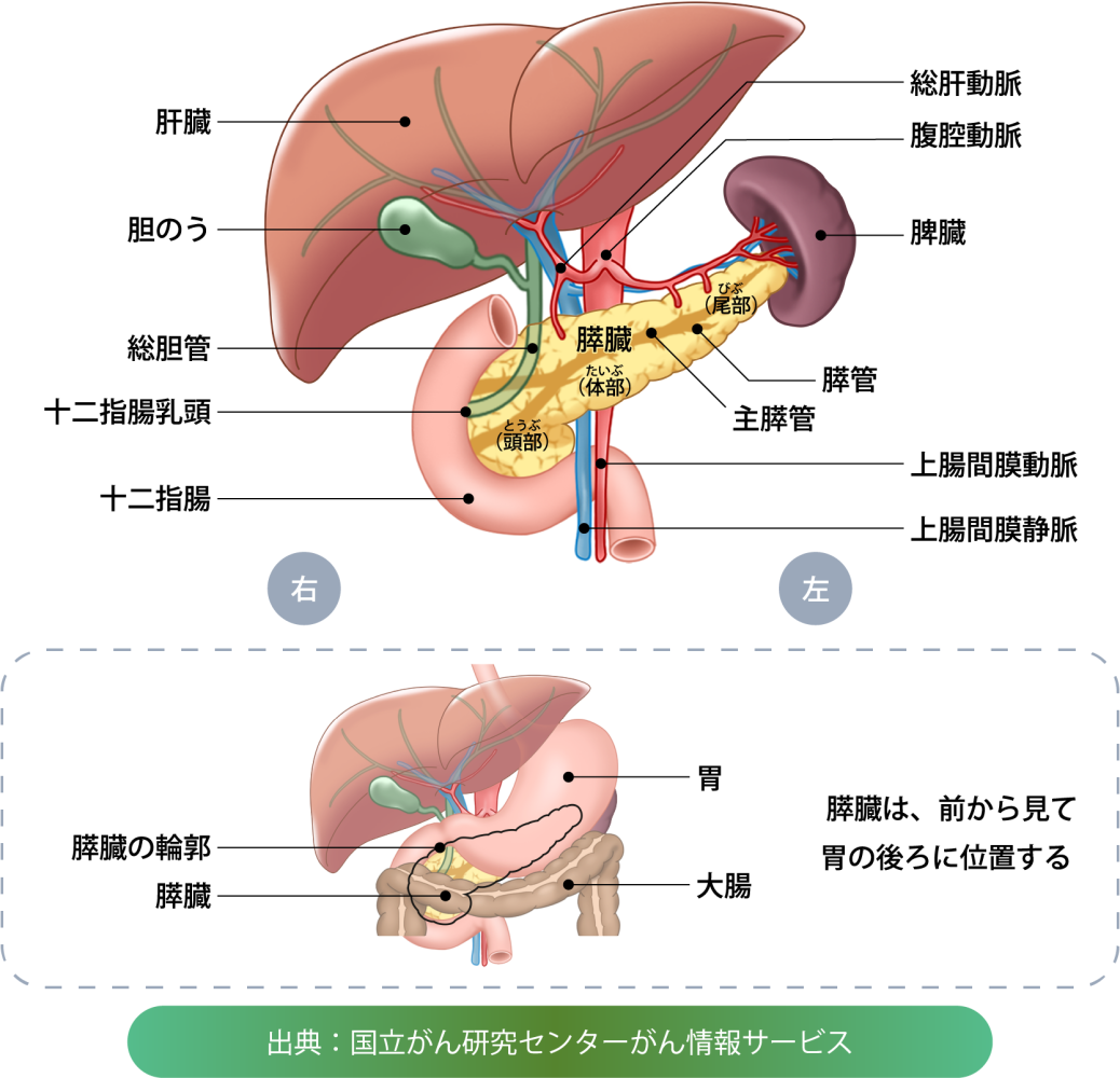 膵臓がんは症状があらわれにくい病気