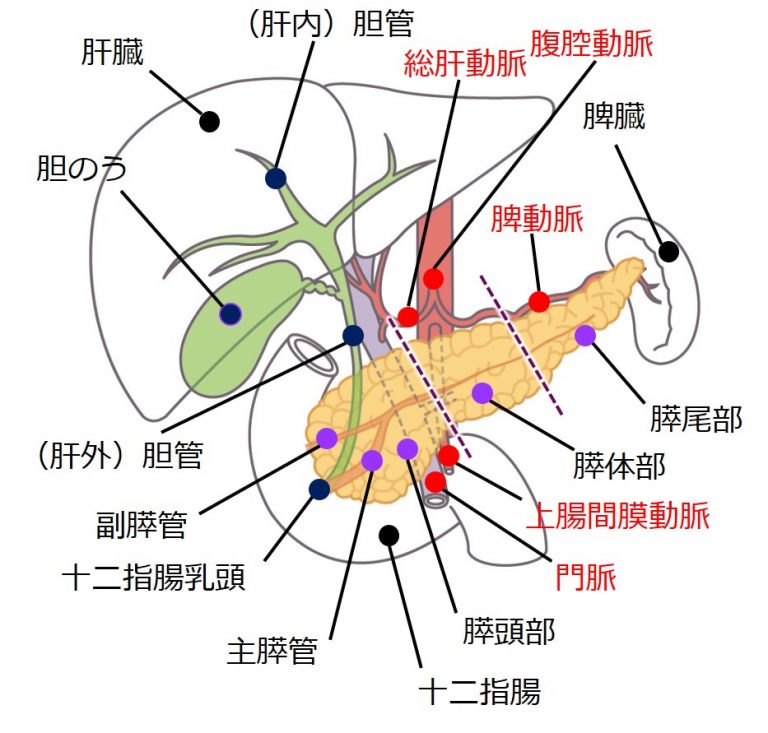 切除可能な状態