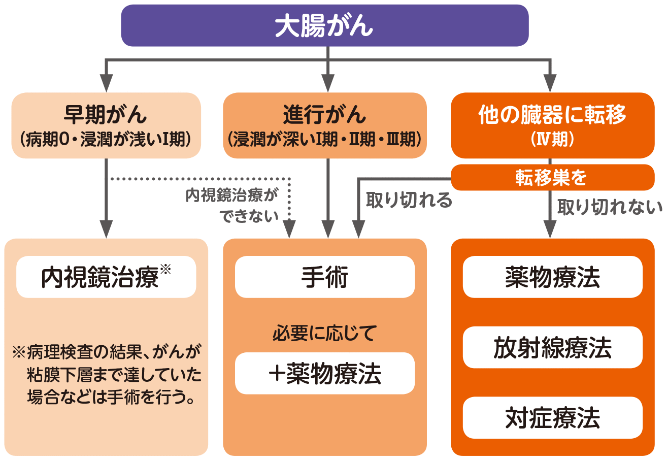 大腸がんステージ1の治療法