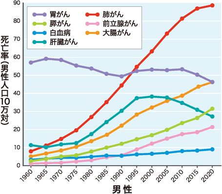 スキルス胃がんの検査1