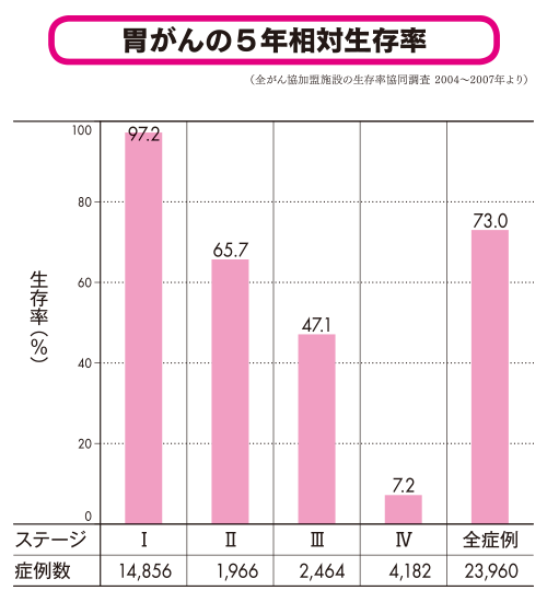 スキルス胃がんの生存率・予後