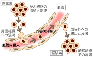 血行性