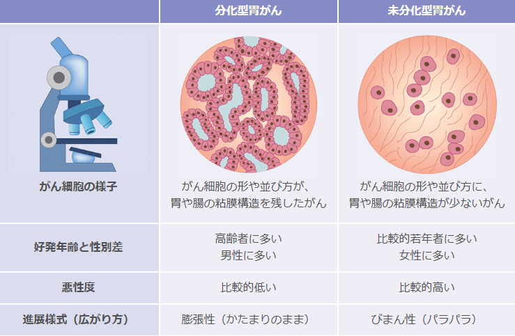 がん細胞の増殖方法によりおおきく2種類にわけられる