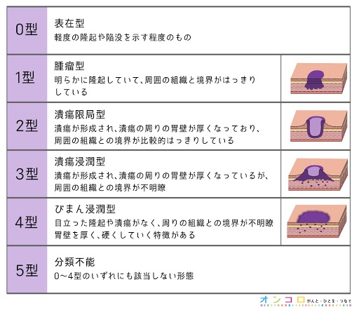 肉眼的分類