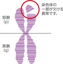 ③造血幹細胞移植