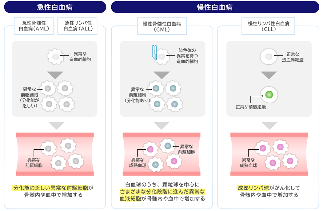 急性と慢性の共通点