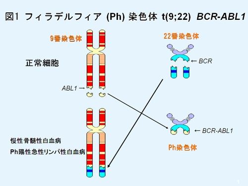 染色体検査で調べること