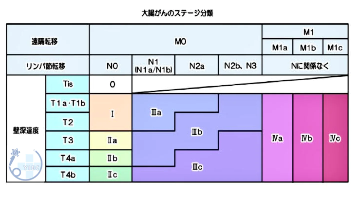 大腸がんのステージ分類