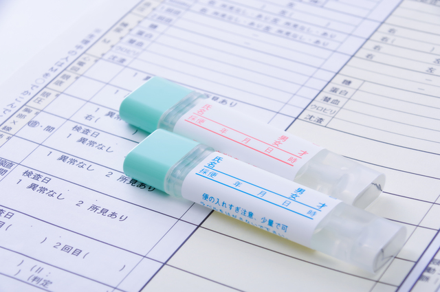 直腸がんの検査方法