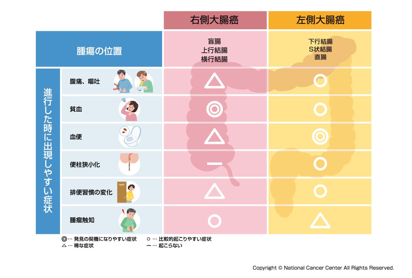 上行結腸がんの症状