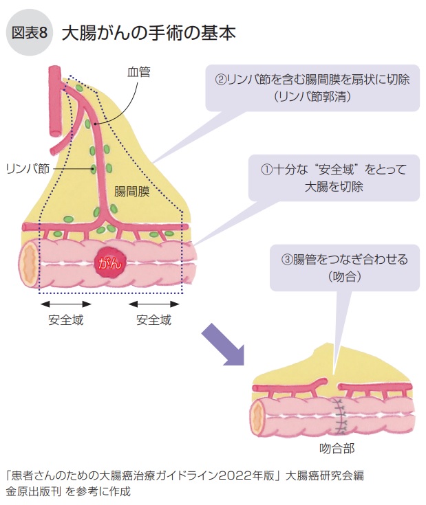 手術