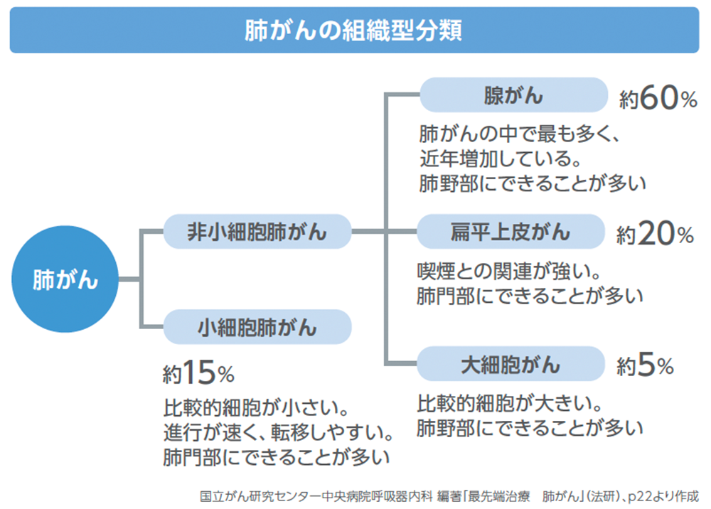 肺がんの種類
