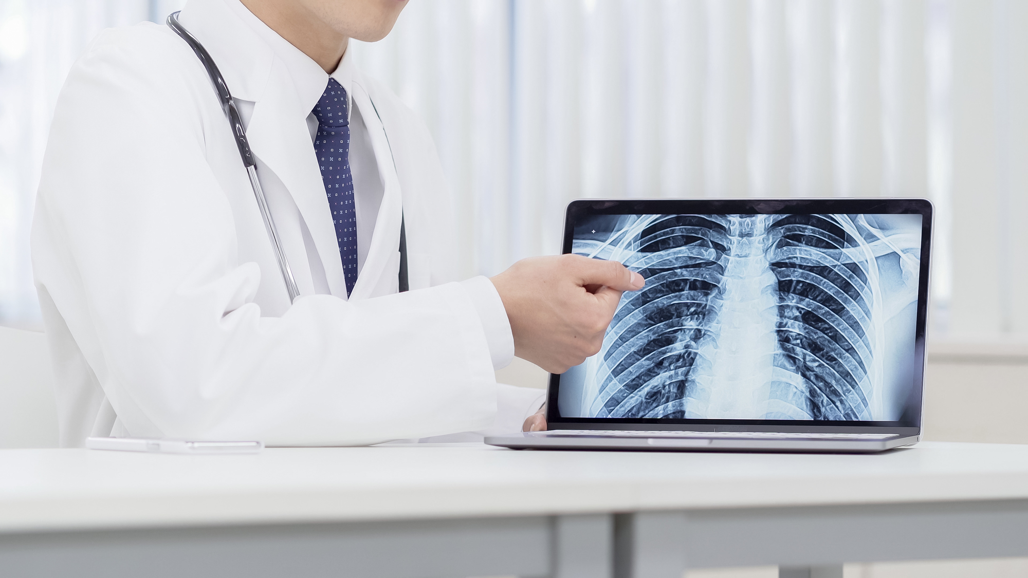 肺がんの治療法