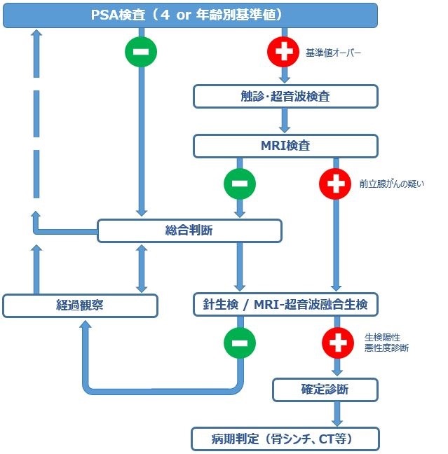 前立腺がんの検査・診断
