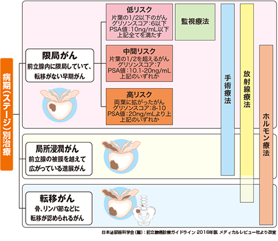前立腺がんの治療
