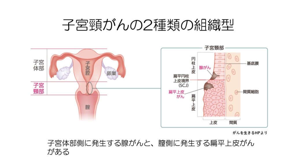 子宮頸がんの性行為以外の要因