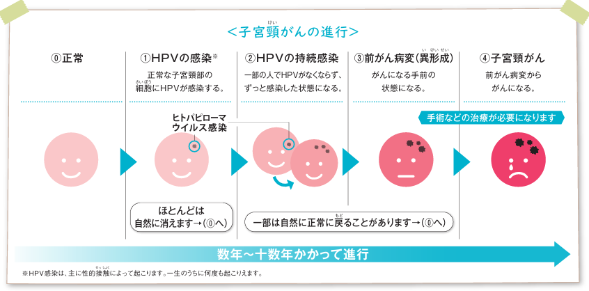 HPVの持続感染率