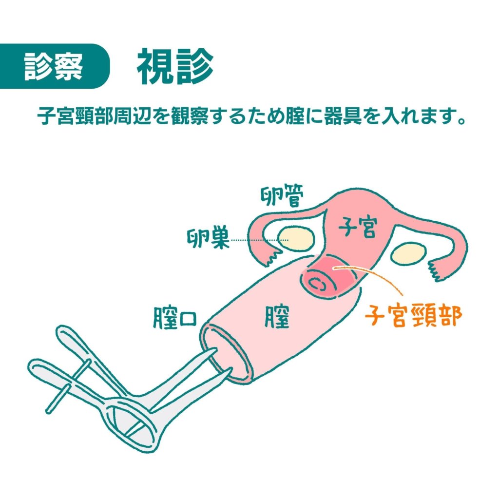 子宮頸がん検診2