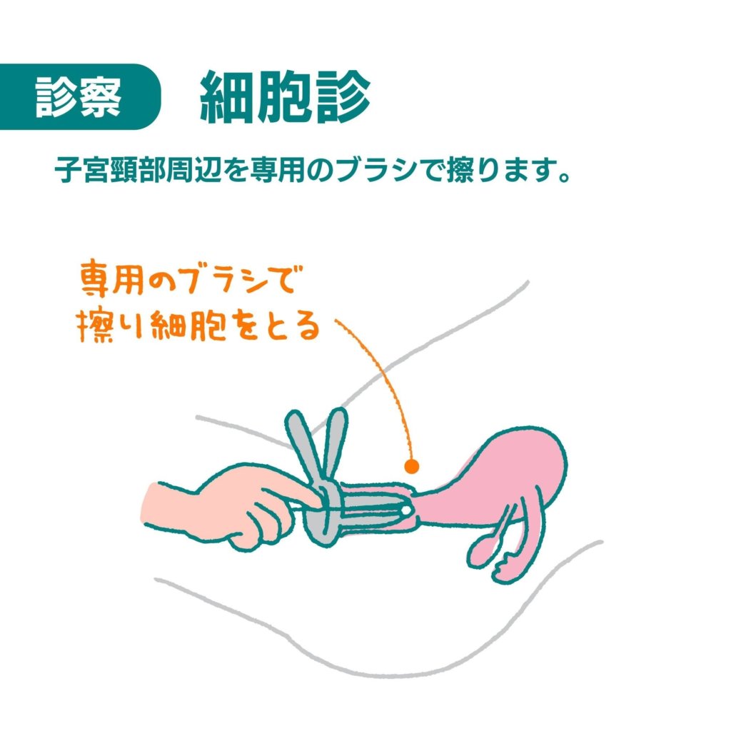 子宮頸がん検診4
