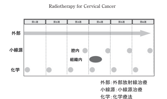 放射線療法