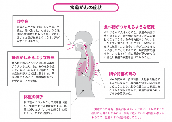 食道がんのみに起こりうる症状