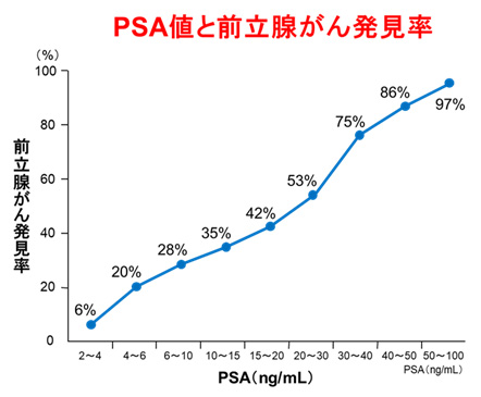 PSA検査（血液検査）
