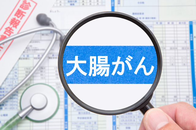 大腸がんの初期症状とは？早期発見のために気にするべきことについて解説！