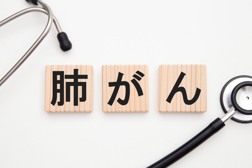 肺がん初期症状とは？見逃しやすい兆候と進行時の変化を徹底解説
