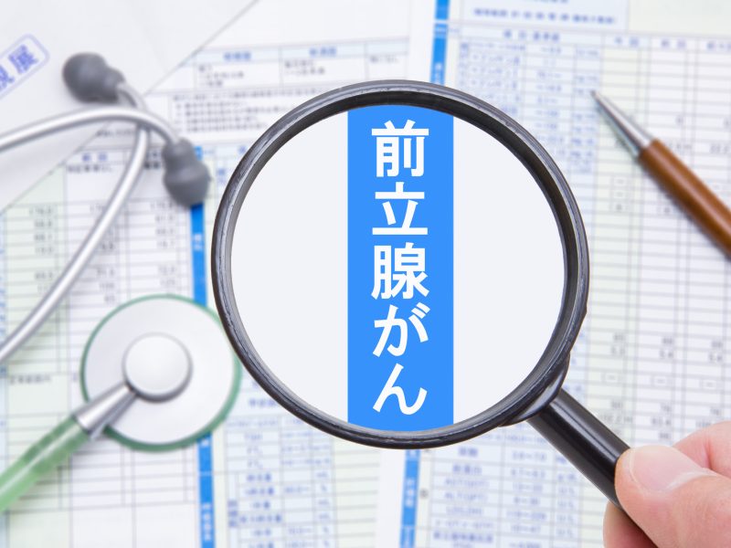 前立腺がんの症状・原因・検査・治療まで徹底解説｜初期症状の気付きから最新の治療法まで