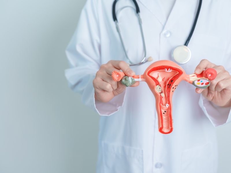 子宮頸がんの原因を医学的に解説｜HPVの持続感染とその他のリスク因子