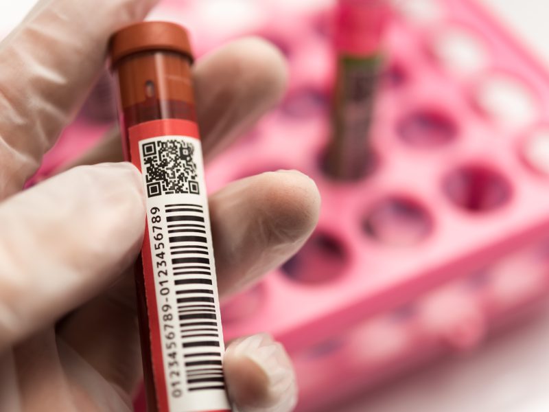 急性リンパ性白血病（ALL）とは｜症状・検査・治療を医師が解説