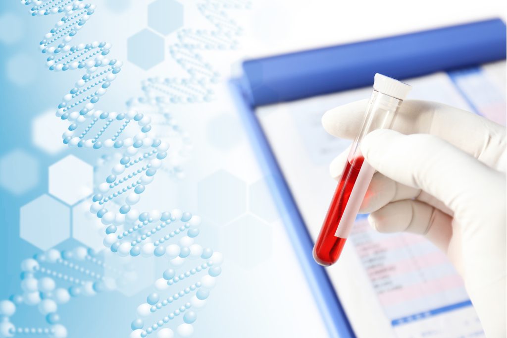 白血病は遺伝する？正しい知識と遺伝子異常の仕組み