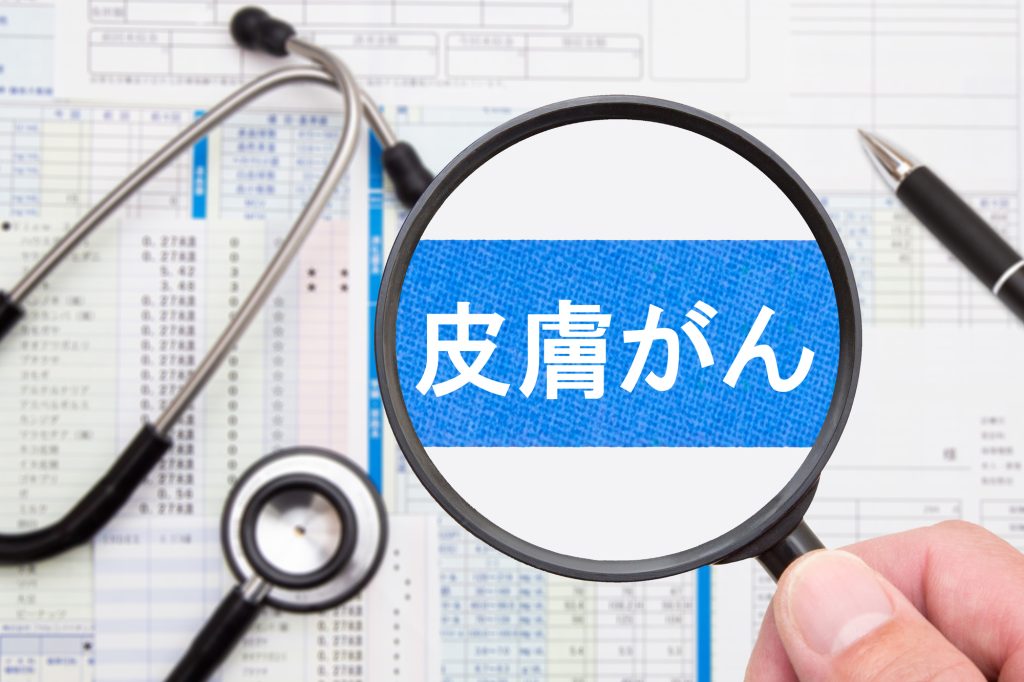 皮膚がんのセルフチェック方法｜ほくろ・シミとの見分け方と受診の目安を解説