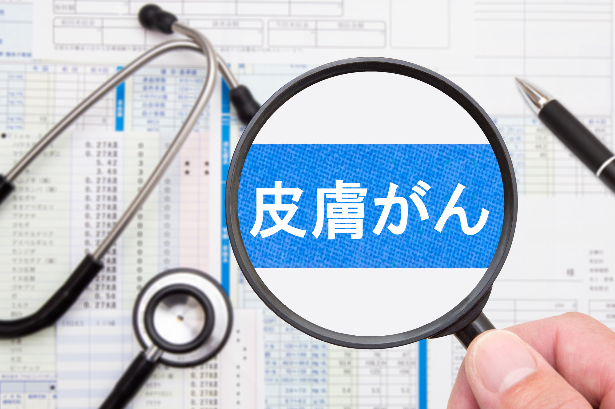 皮膚がんのセルフチェック方法｜ほくろ・シミとの見分け方と受診の目安を解説